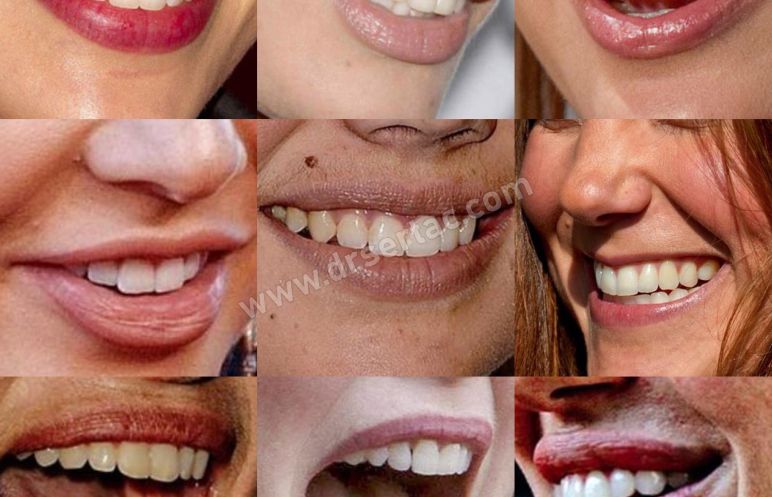Dişler hakkında doğru bilinen yanlışlar